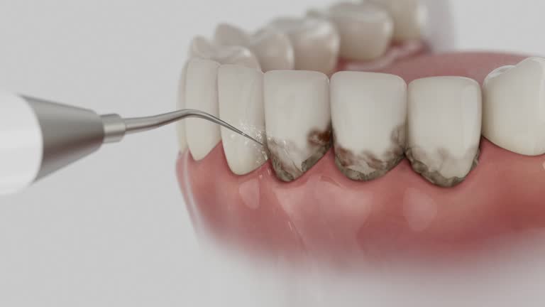 Trusted Emergency Dentist service in Choudrant, LA - Dentist Open Now